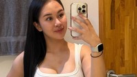 Pesona Yasmine Karenina setelah menjalani sederet tindakan kecantikan. (Foto: dok Instagram yasminezka)