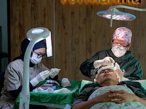 Wendi Cagur Transplantasi Rambut Karena Keinginan Sejak Lama