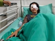 Pria di Palembang Diduga Tusuk Mata Istri Sirinya Pakai Cutter