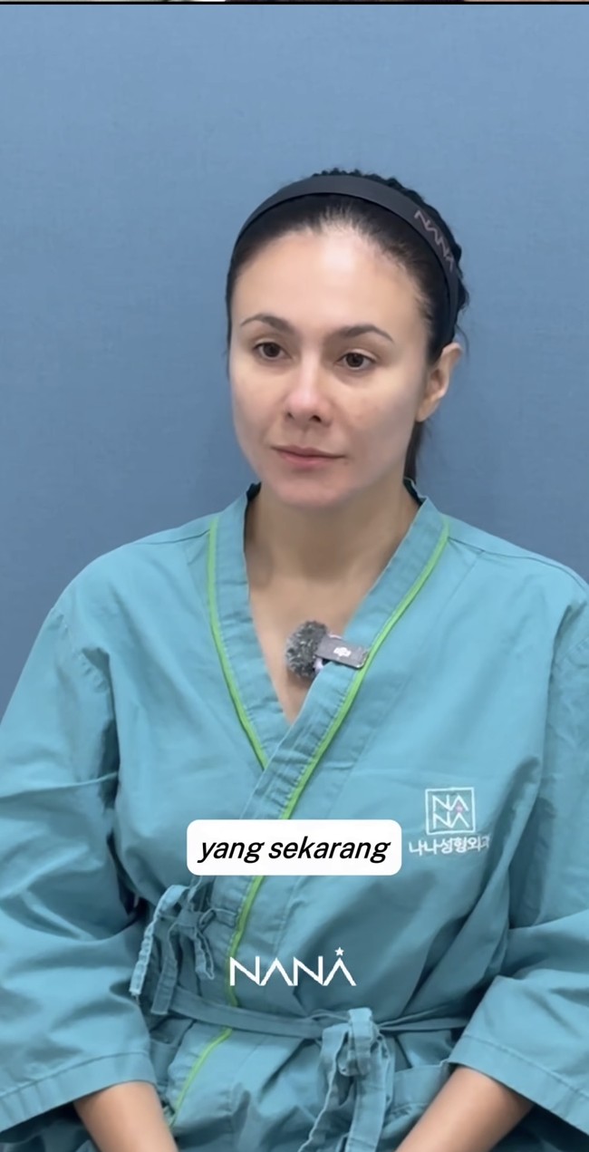 Wulan Guritno beberapa waktu lalu bertolak ke Korea. Ternyata kepergiannya itu bertujuan untuk menjalani operasi plastik di sana. Foto: Instagram/@wulanguritno