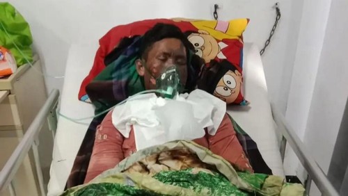 Muhammad Ikbal meninggal dunia saat dirawat di RSUD NTB, Mataram, pada Mingg  (28/2/2026). (Istimewa)