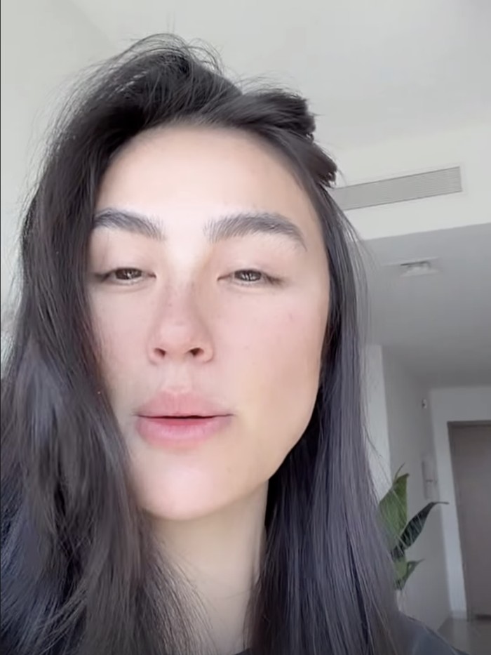 Kondisi Agnez Mo di Dubai.