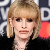 Banyak pengguna media sosial menyebut penampilannya terlihat sangat tirus dan rapuh. Beberapa komentar bahkan terdengar cukup keras. “Oh Kelly aku berharap kamu segera mendapatkan pertolongan,” tulis netizen. Seorang penggemar menyebut Kelly terlihat “tidak sehat” dan menyarankan agar ia “mencari ahli nutrisi dan menambah berat badan.” Foto: Getty Images/JMEnternational