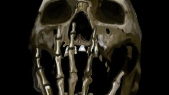 Hal paling menakutkan yang pernah saya temukan adalah kasus menguap peti mati paling ekstrem yang pernah saya lihat. Menguap peti mati kurang lebih seperti yang Anda bayangkan. Ketika seseorang meninggal, otot-ototnya akhirnya mengendur, dan ini berarti rahang akan terbuka lebar. Karena alasan inilah, secara historis, jenazah dikuburkan dengan kain yang mengikat dagu agar tertutup (seperti Marley dalam A Christmas Carol), atau, di zaman modern; rahang diikat dengan kawat. Foto: Boredpanda