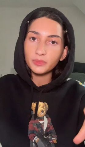 Ngeri! Wanita Ini Alami 'Luka Bakar' di Mulut Usai Telan Dry Ice