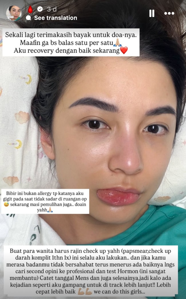 Setelah operasi, bibirnya sempat bengkak karena tanpa sadar tergigit olehnya selama proses operasi. Namun terlihat wajah Chelsea sudah kembali segar dan tetap glowing. Foto: Instagram/@chelseaoliviaa