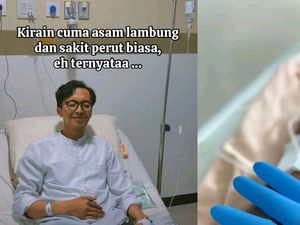 Viral Pria Bandung Kena Kanker Usus Besar di Usia 20-an, Sempat Dikira Asam Lambung