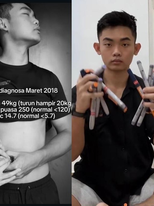 Kisah Pasien DM Tipe 1