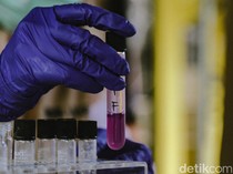 BBPOM Palembang Intensifkan Pengawasan Pangan Jelang Idul Adha