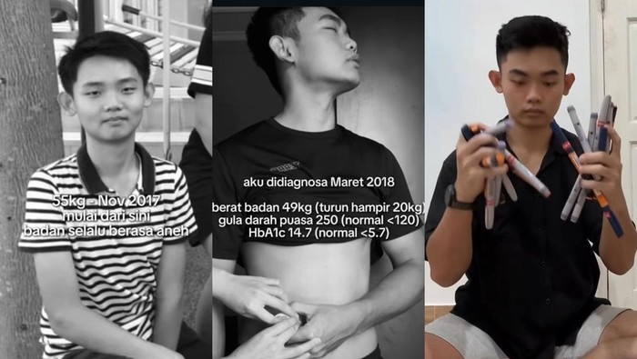 Pria Denpasar idap diabetes tipe 1