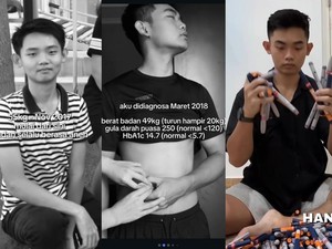 Pria Usia 23 di Denpasar Idap Diabetes Tipe 1, Ini Kata Dokter soal Gejalanya