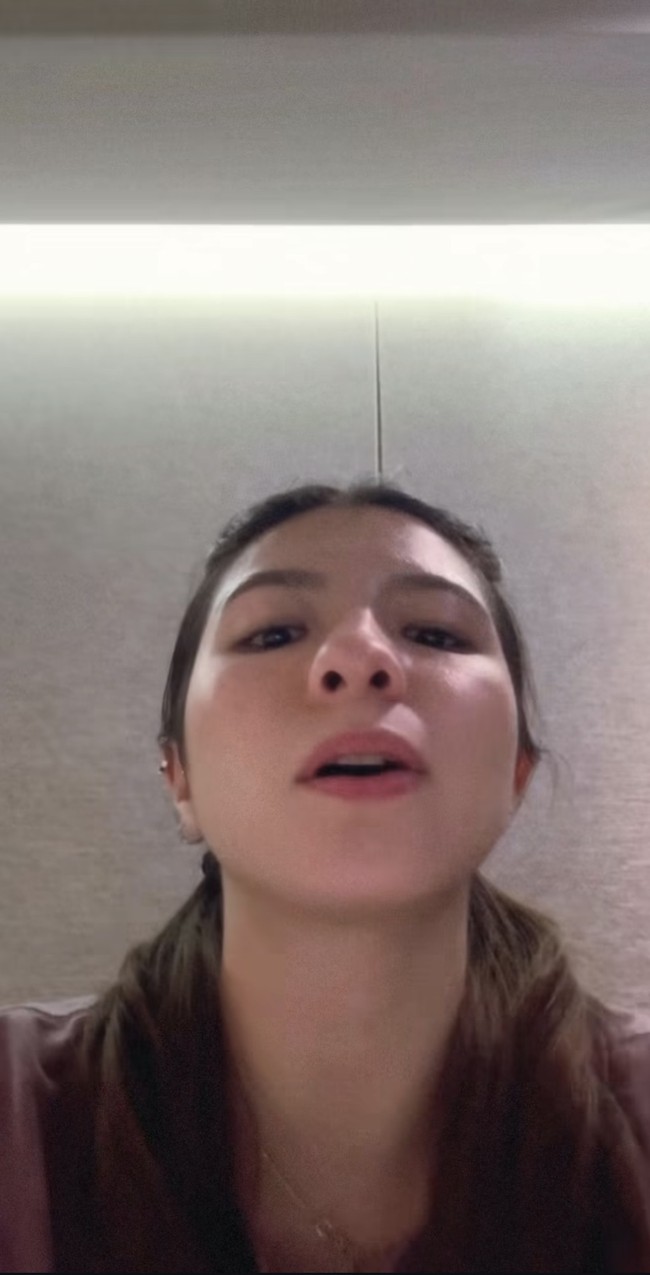 Shalom mengaku memiliki hidung yang bengkok. Hal itu membuatnya jadi kesulitan bernapas hingga memilih jalan operasi untuk memperbaiki bentuknya. Foto: Instagram/@sharazaaa