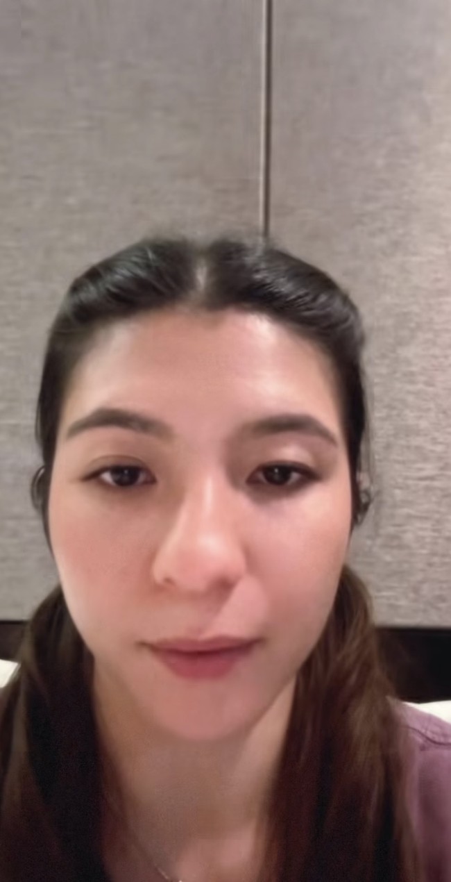 Ia juga menjalani operasi kelopak mata untuk menyamakan kedua matanya. Diakui Shalom bagian mata sebelah kanannya hampir seperti tak memiliki kelopak, berbeda dengan bagian kirinya. Foto: Instagram/@sharazaaa