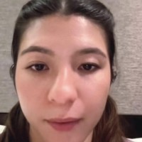 Ia juga menjalani operasi kelopak mata untuk menyamakan kedua matanya. Diakui Shalom bagian mata sebelah kanannya hampir seperti tak memiliki kelopak, berbeda dengan bagian kirinya. Foto: Instagram/@sharazaaa