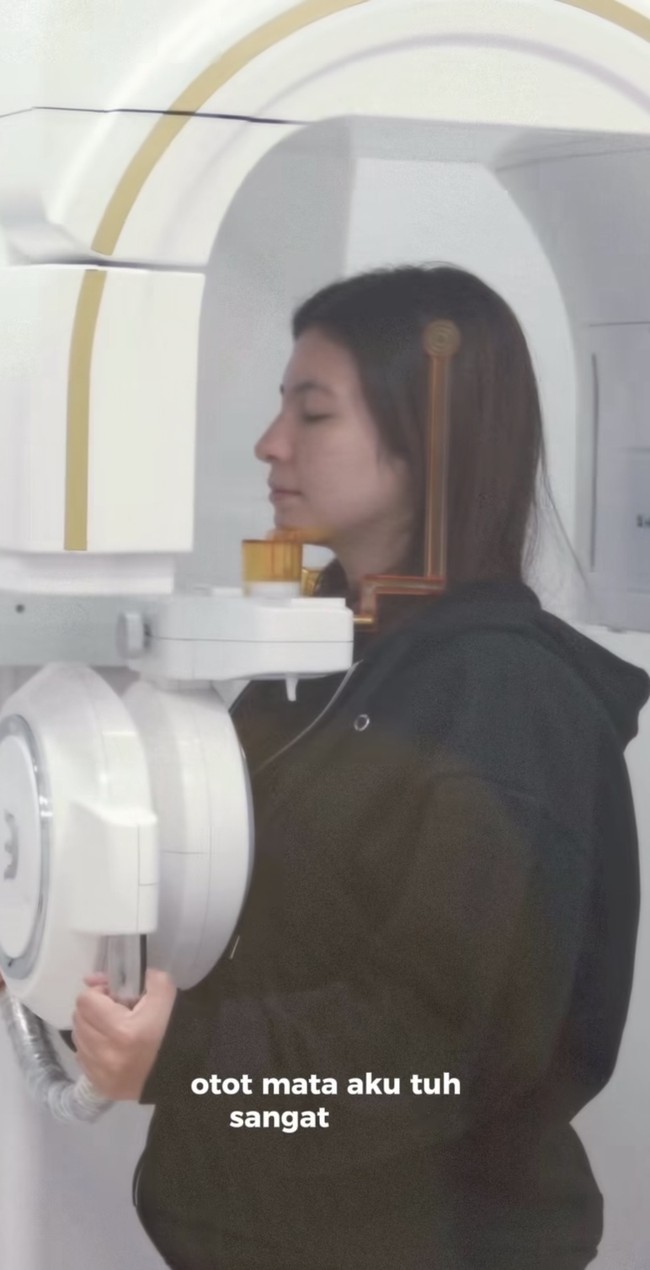 Bagian mata Shalom juga diperiksa. Hasil pemeriksaan mengungkapkan bahwa otot mata Shalom sangat lemah dan mata kanannya terlihat lelah. Foto: Instagram/@sharazaaa