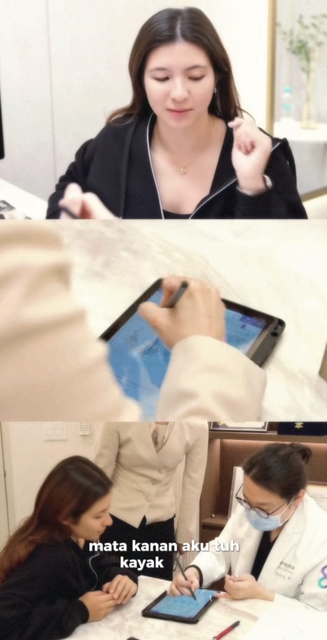 Dari keterangan unggahannya diketahui Shalom menjalani operasi upper blepharoplasty dan ptosis correction untuk kelopak matanya, serta functional rhinoplasty untuk memperbaiki bagian hidung. Foto: Instagram/@sharazaaa