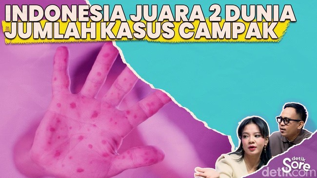 Video: dr. Piprim IDAI Ungkap Alasan Jumlah Kasus Campak di RI Meningkat