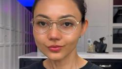 Cerita Rina Nose Operasi Hidung Pakai Tulang Iga, Bikin Wajah Jadi Ningrat