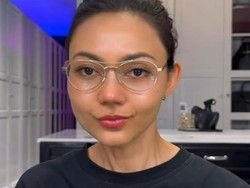 Cerita Rina Nose Operasi Hidung Pakai Tulang Iga, Bikin Wajah Jadi Ningrat