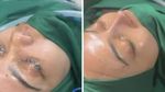 Penampilan Rina Nose Sebelum dan Sesudah Operasi Hidung yang Bikin Pangling