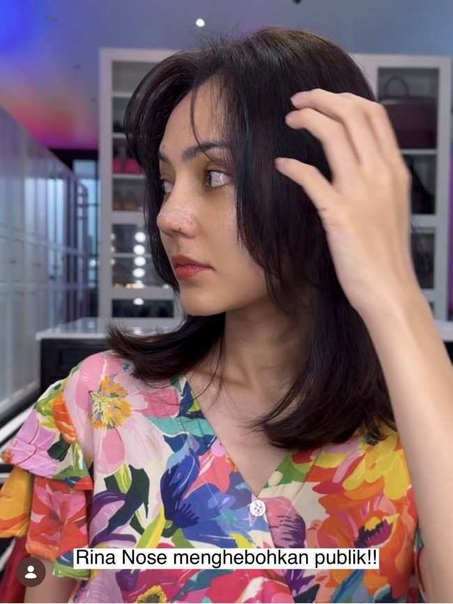 Rina Nose baru saja membagikan kabar bahwa dirinya diam-diam sudah menjalani rhinoplasty untuk mengubah bentuk hidungnya. Melalui akun Instagram pribadi, Rina membagikan perjalanannya menjalani oplas tersebut. Foto: Instagram/@rinanose16