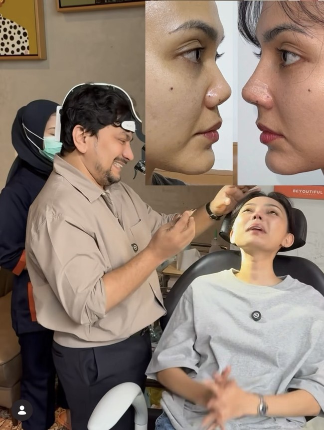 Dengan hidung baru yang lebih mancung, Rina kini menjuluki dirinya sendiri dengan Rina Nose Pro Max. Penampilannya pun banjir pujian netizen. Foto: Instagram/@rinanose16