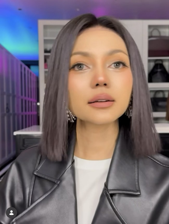 Setelah menjalani rhinoplasty, tampak jelas hidungnya kini menjadi jauh lebih mancung. Rina pun terlihat semakin percaya diri memamerkan penampilan barunya. Foto: Instagram/@rinanose16