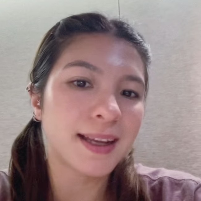 Ini Bagian Wajah Shalom Razade yang Bermasalah Sebelum Dioperasi