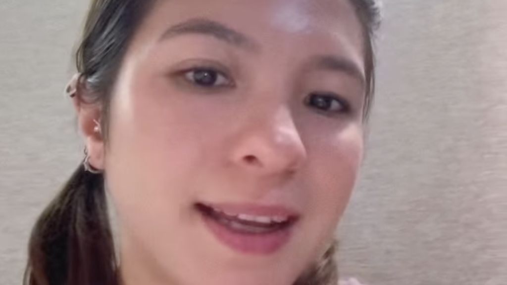 Ini Bagian Wajah Shalom Razade yang Bermasalah Sebelum Dioperasi