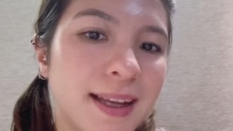 Ini Bagian Wajah Shalom Razade yang Bermasalah Sebelum Dioperasi