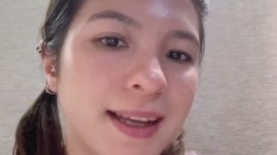 Ini Bagian Wajah Shalom Razade yang Bermasalah Sebelum Dioperasi