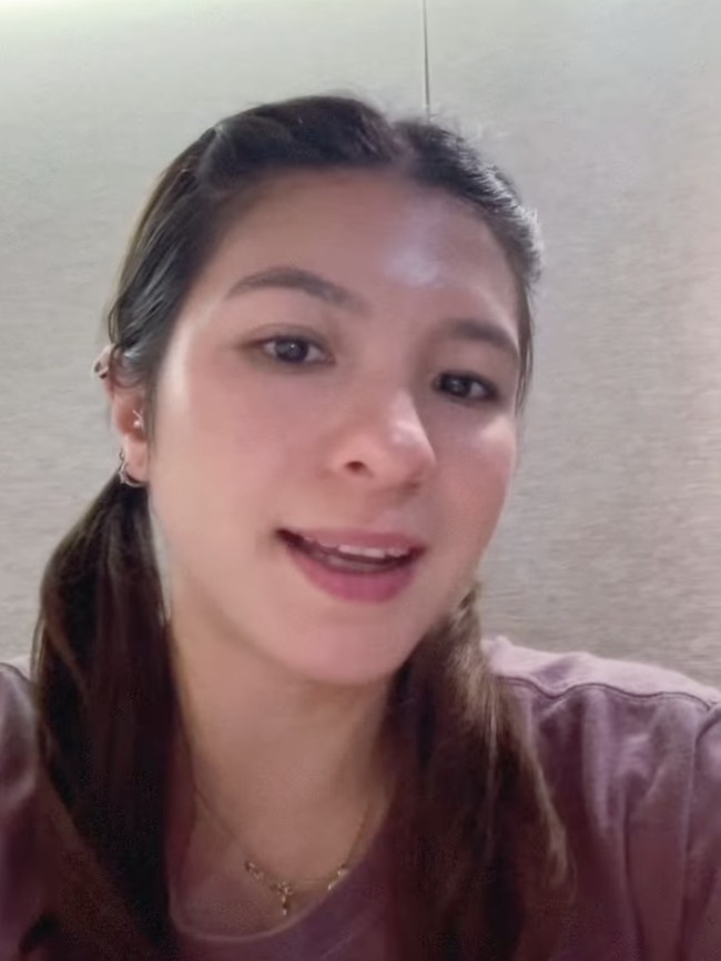 Ini Bagian Wajah Shalom Razade yang Bermasalah Sebelum Dioperasi