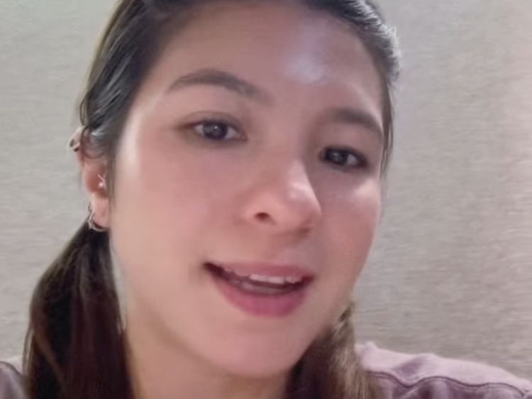 Ini Bagian Wajah Shalom Razade yang Bermasalah Sebelum Dioperasi