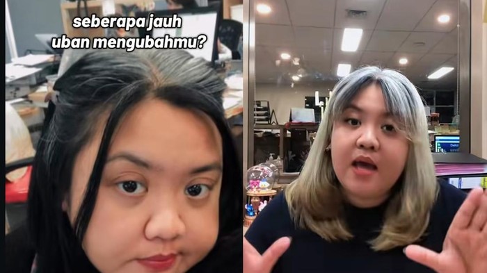 Perempuan dengan kondisi silver hair.
