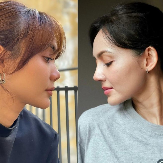 Rina Nose Perlihatkan Before-After Hidung Usai Oplas, Pangling Gak?