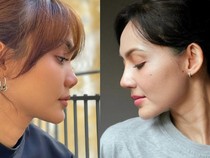 Rina Nose Perlihatkan Before-After Hidung Usai Oplas, Pangling Gak?