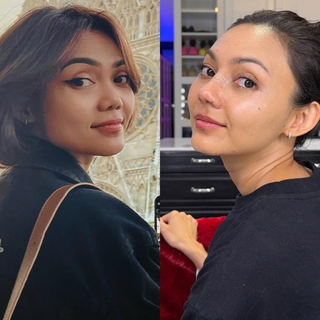 Penampilan Rina Nose Sebelum dan Sesudah Operasi Hidung yang Bikin Pangling