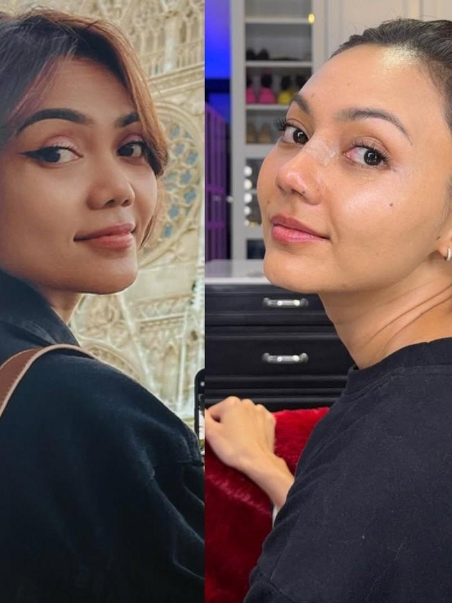 Penampilan Rina Nose Sebelum dan Sesudah Operasi Hidung yang Bikin Pangling