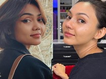 Penampilan Rina Nose Sebelum dan Sesudah Operasi Hidung yang Bikin Pangling