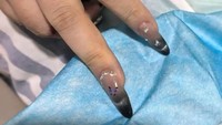 Kisah Wanita Hampir Kehilangan Nyawa Karena Manikur Gel