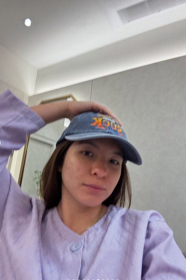 Wanita 27 tahun itu juga memamerkan fotonya saat sudah berganti pakaian dengan baju operasi berwarna ungu. Shalom tampil bareface memamerkan wajah aslinya tanpa makeup sedikitpun. Foto: Instagram/@sharazaaa