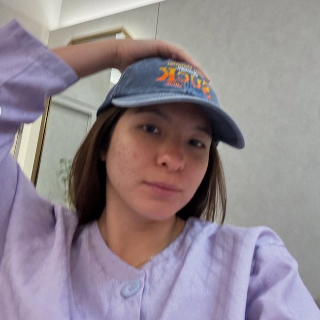 Detik-detik Shalom Razade Operasi Plastik, Hidung Dicoret-coret Dokter