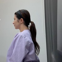 Shalom mengaku merasa deg-degan saat menunggu operasi plastik pertamanya itu. “nunggu masuk ruang operasi cuma dag dig dug dag dig dug. tegang banget karena ini operasi pertama di hidup aku, jd kepala udah kemana-mana,” tulisnya. Sebelum tindakan, wajah Shalom juga tampak difoto untuk nantinya dibandingkan dengan wajahnya setelah operasi. Foto: Instagram/@sharazaaa