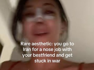 Viral Kisah Influencer Pergi ke Iran Untuk Oplas Hidung, Berakhir Terjebak
