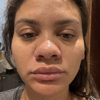 Curhat Beauty Influencer Syok Wajahnya Berubah Drastis Saat Hamil