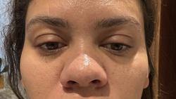 Curhat Beauty Influencer Syok Wajahnya Berubah Drastis Saat Hamil