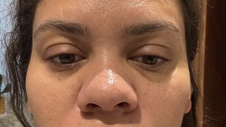 Curhat Beauty Influencer Syok Wajahnya Berubah Drastis Saat Hamil