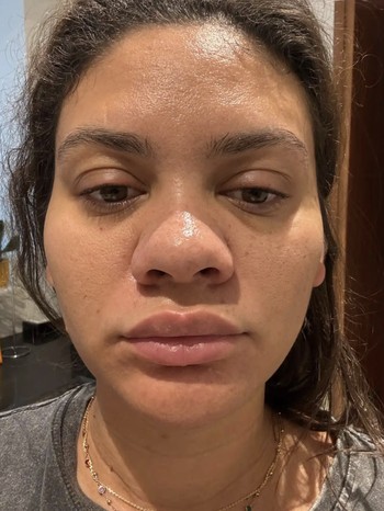 Curhat Beauty Influencer Syok Wajahnya Berubah Drastis Saat Hamil