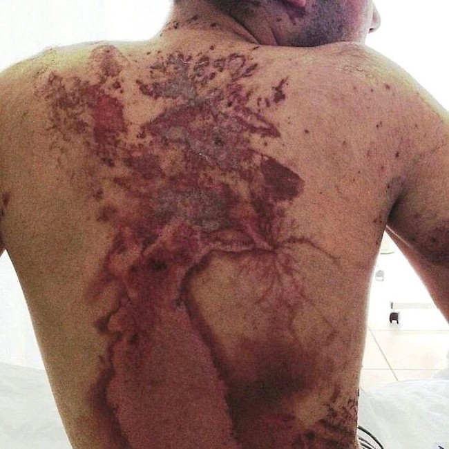 Ngeri! Deretan Gambar Medis Ini Bikin Merinding