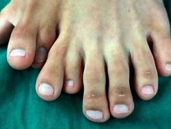 Ngeri! Deretan Gambar Medis Ini Bikin Merinding